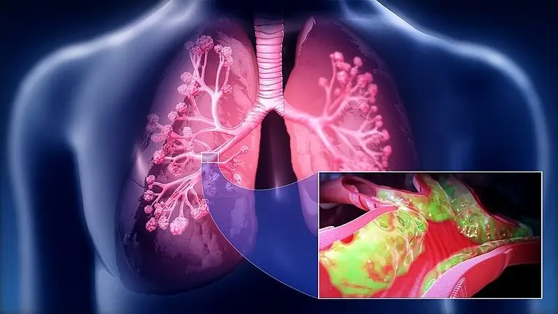 Image credit: Wikimedia Commons | Scientific Animations