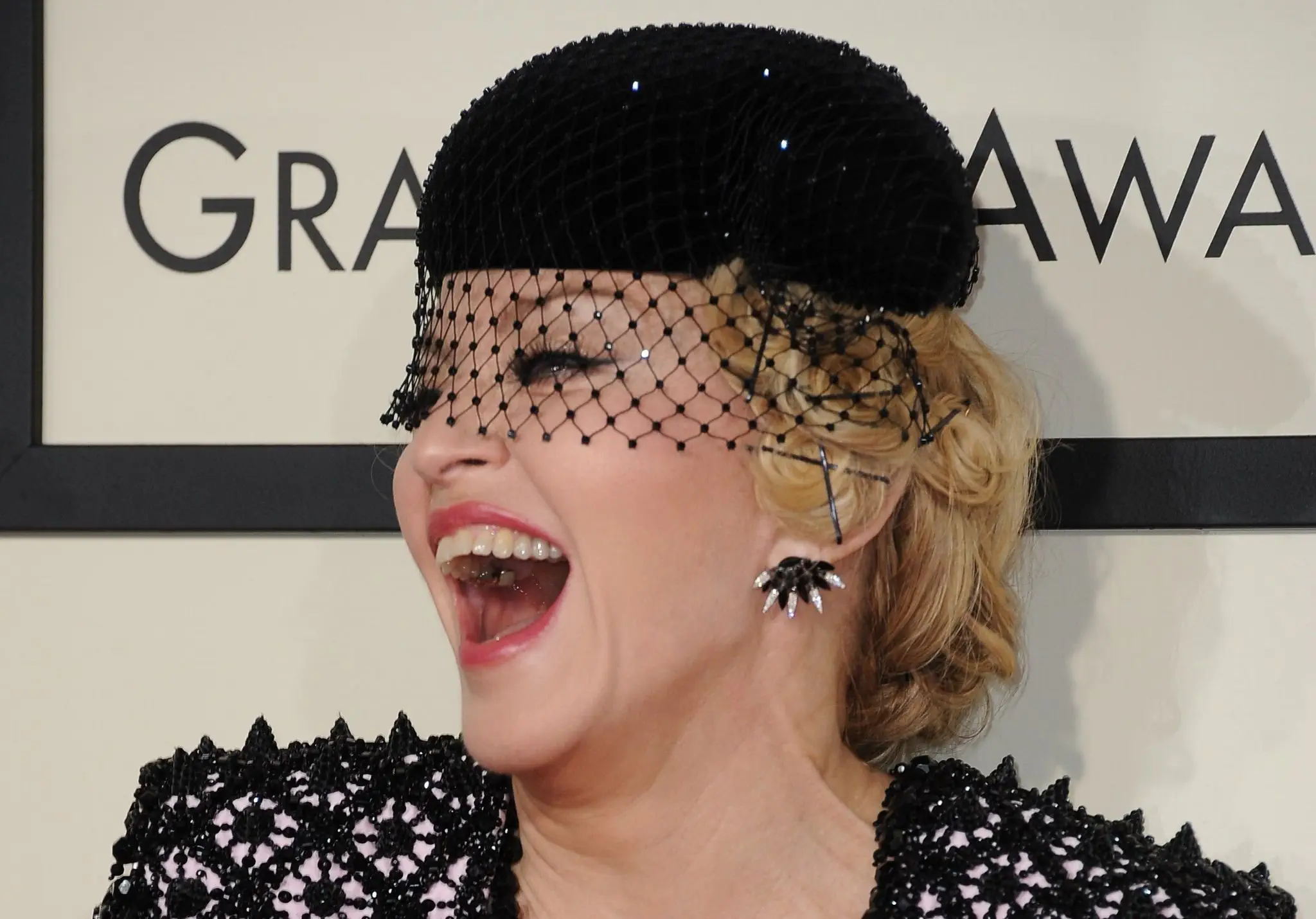 Image credit: Flickr | girls teeth