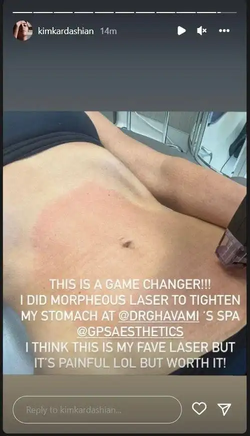 Image credit: instagramStories | @kimkardashian