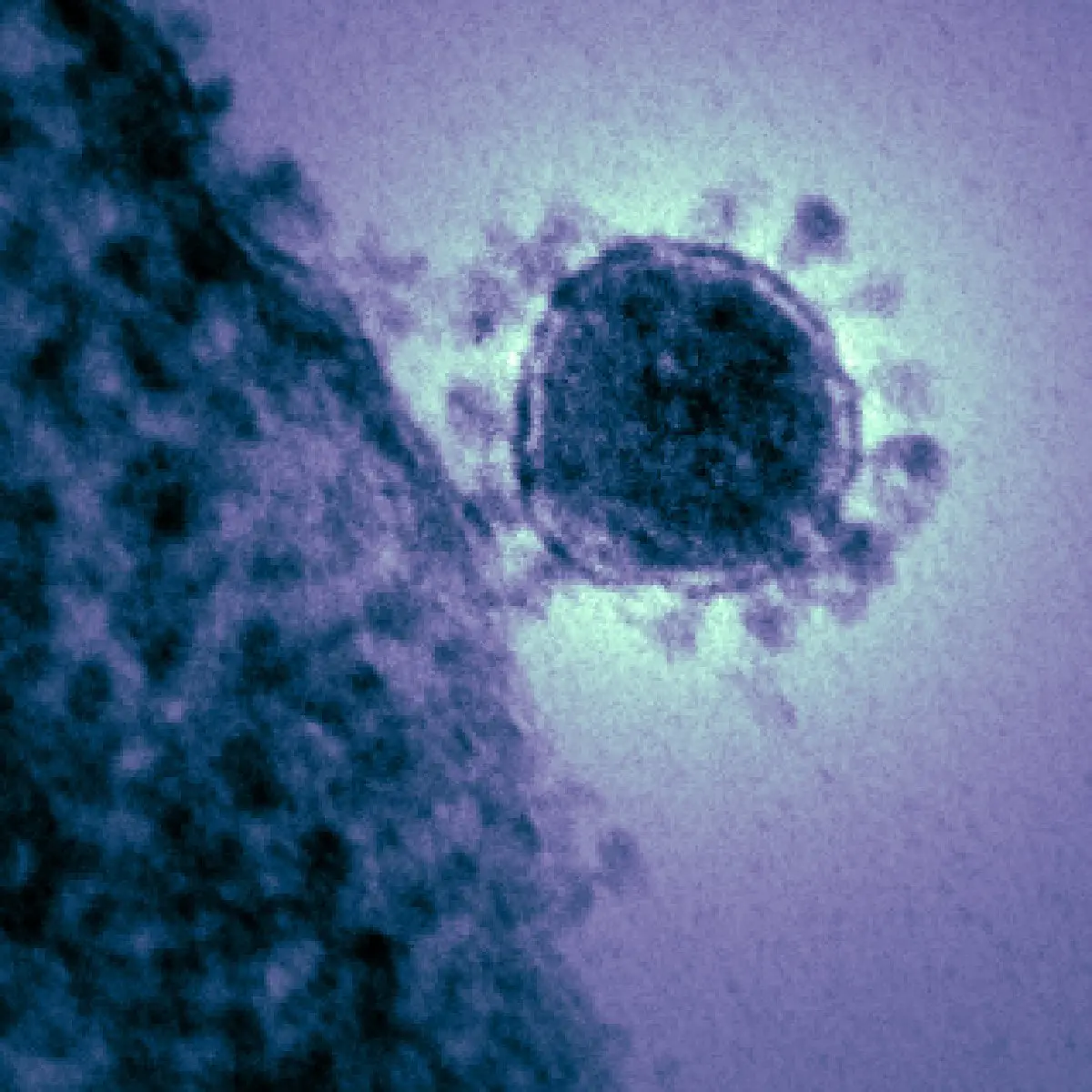 Image credit: https://diplycom5cc47.zapwp.com/q:i/r:0/wp:1/w:1/u:https://commons.wikimedia.org/wiki/File:Middle_East_respiratory_syndrome-related_coronavirus.jpg