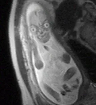 Image credit: SiriusBlackMD