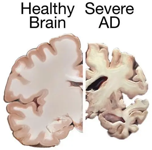 Image credit: Wikipedia