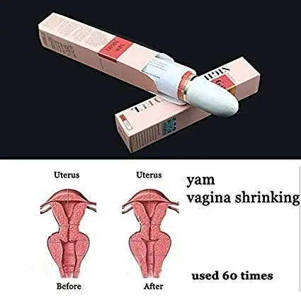 Image credit: Amazon | Generic