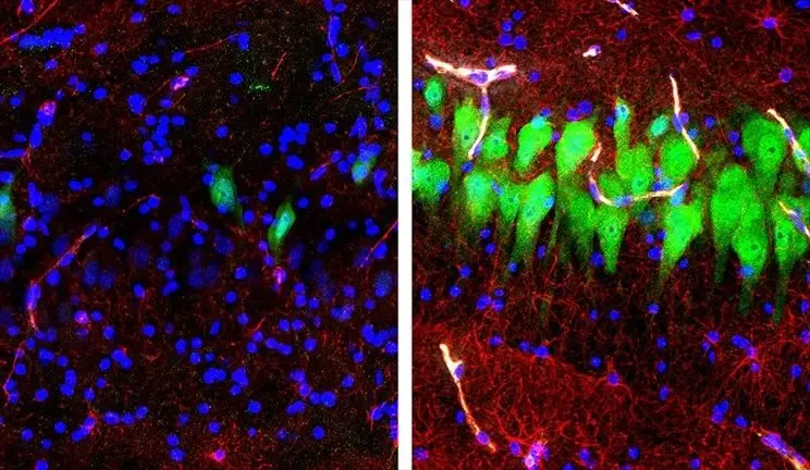 Image credit: Yale School of Medicine