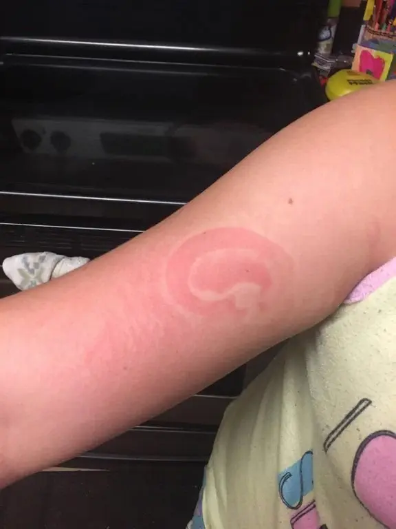 Image credit: Reddit | FysicalGrafiti