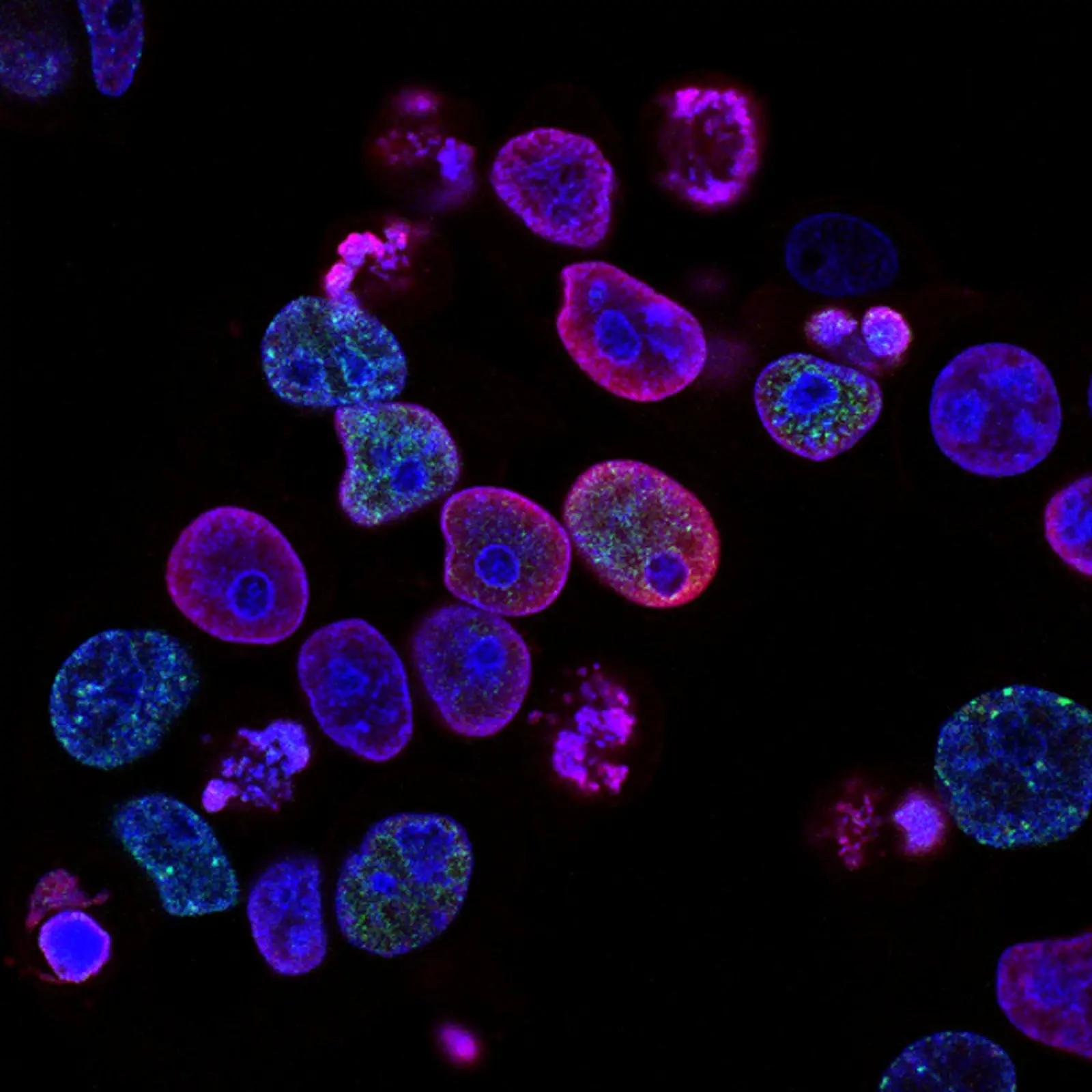 Image credit: Unsplash | National Cancer Institute