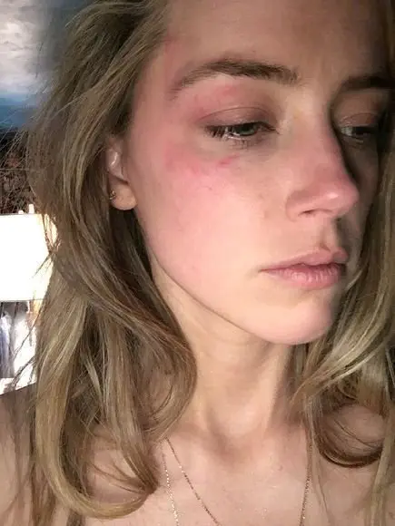 Image credit: Amber Heard