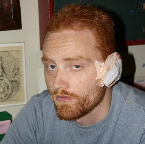 Image credit: Imgur | beingginger