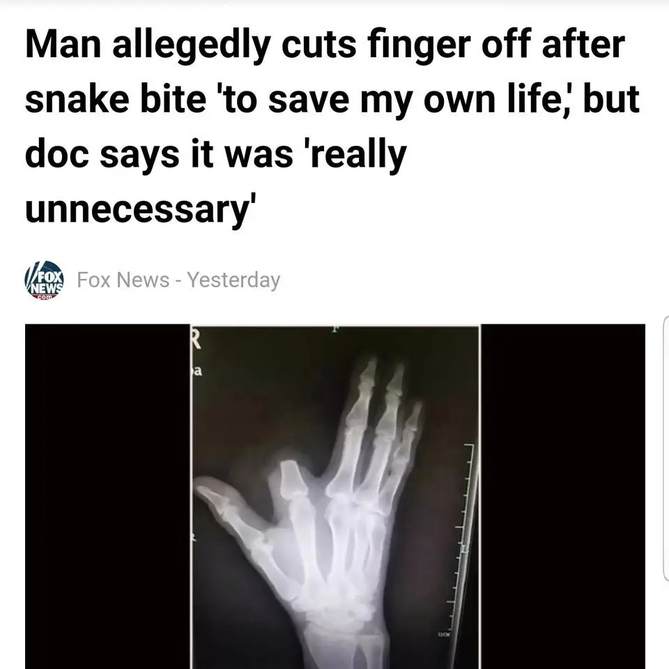 Image credit: Reddit | HighSnark