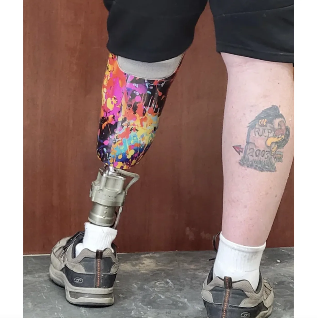 Image credit: Reddit | Odontologist001