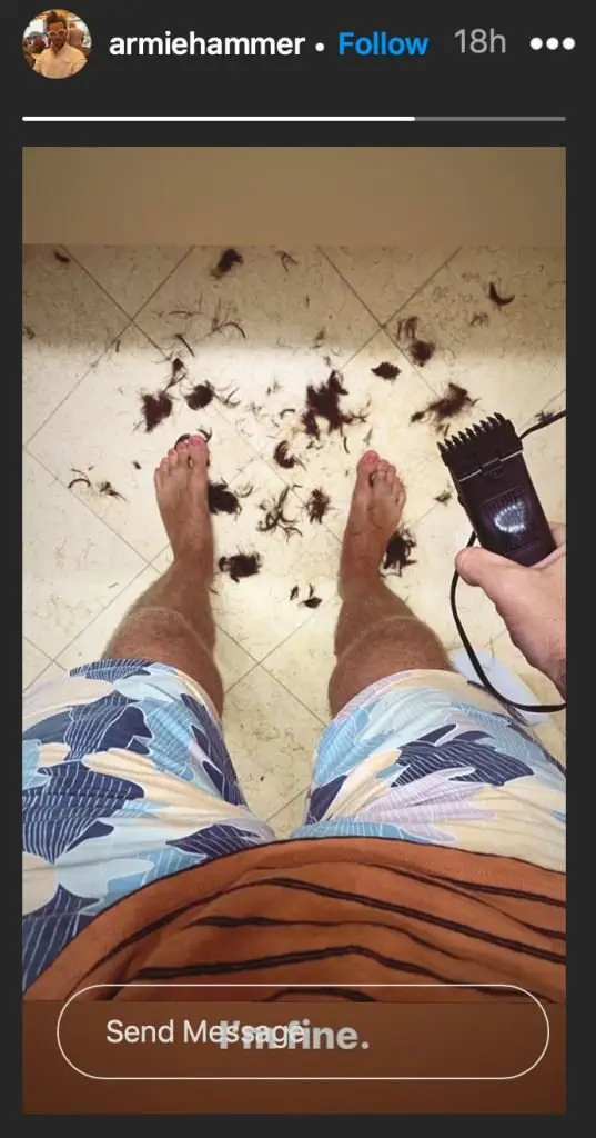 Image credit: Instagram | @armiehammer