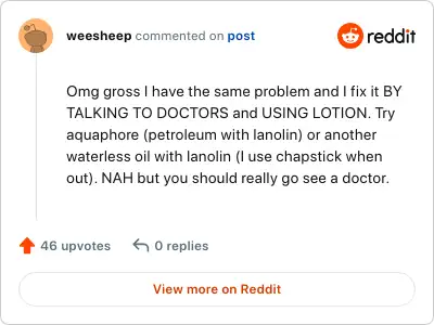Image credit: weesheep | weesheep