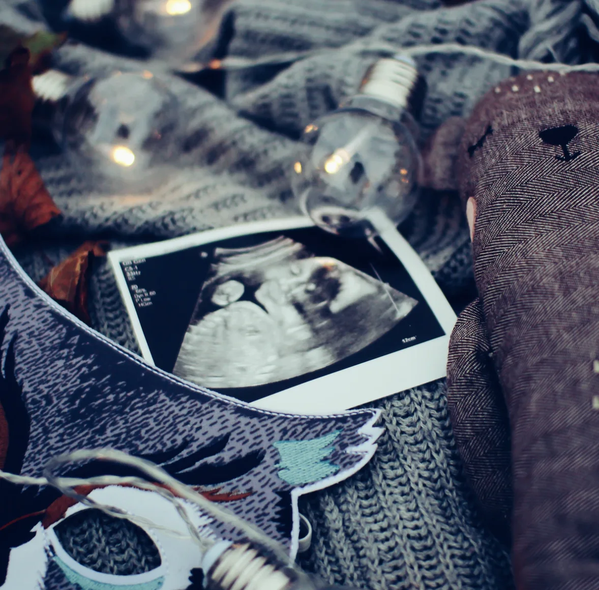 Image credit: Unsplash | Daiga Ellaby