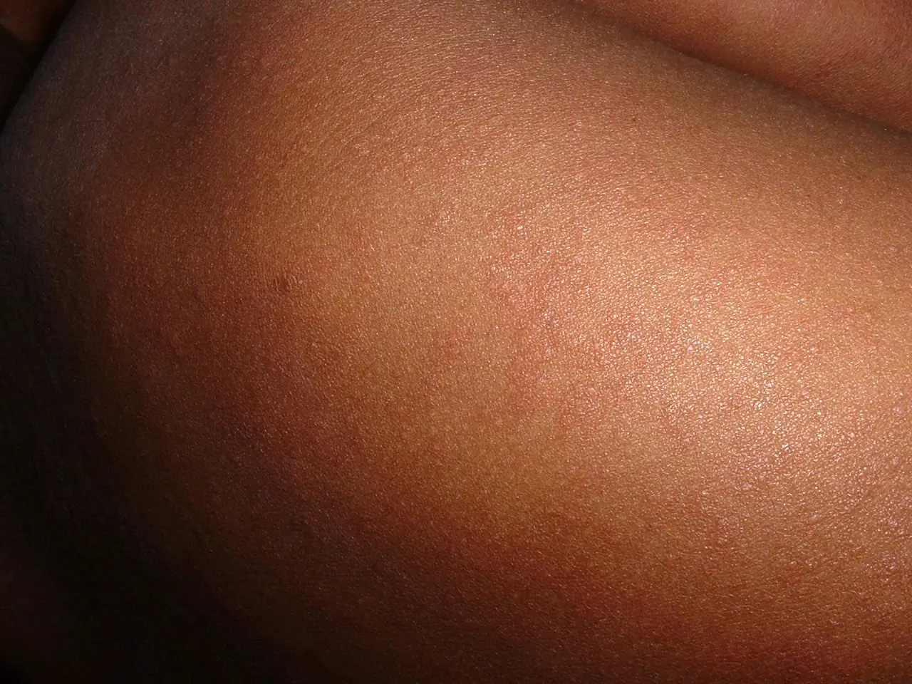 Image credit: https://diplycom5cc47.zapwp.com/q:i/r:0/wp:1/w:1/u:https://commons.wikimedia.org/wiki/File:Measles_in_African_Child_2.JPG