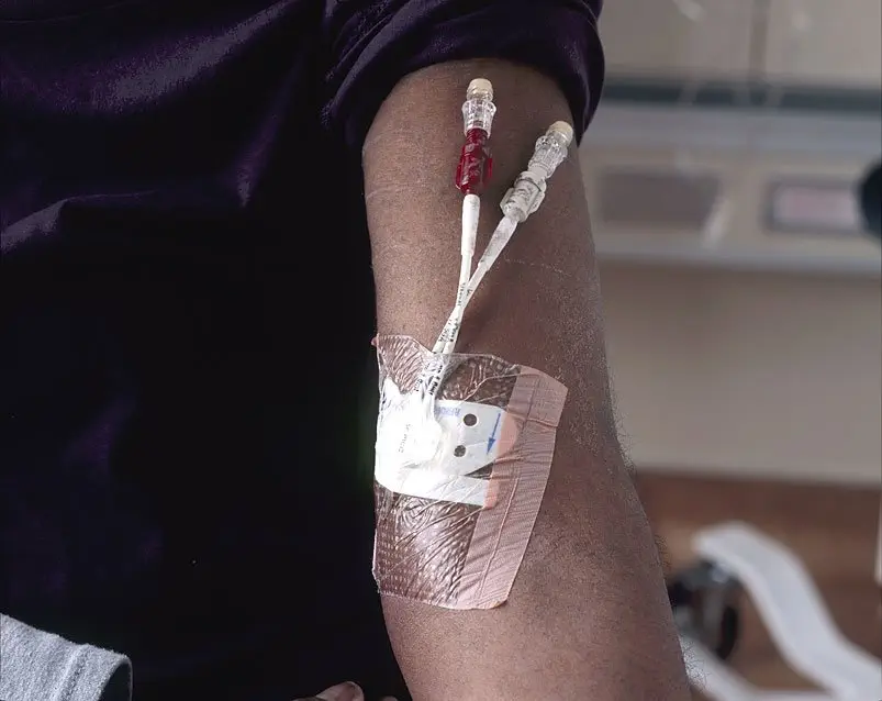 Image credit: https://commons.wikimedia.org/wiki/File:Catheter_for_chemotherapy_(1).jpg