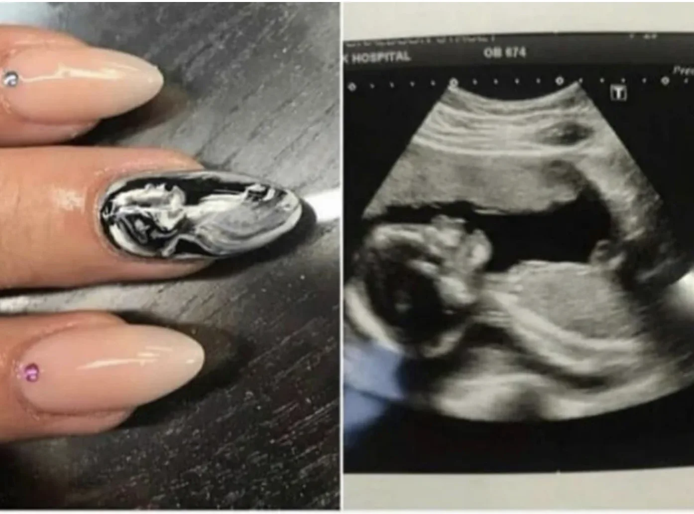 Image credit: Reddit | OnionCustard