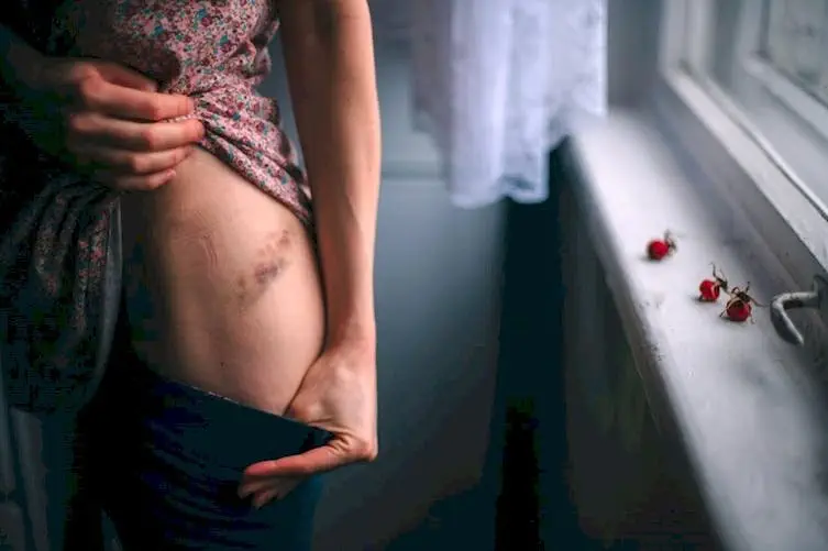 Image credit: Getty Images | Andrei Box Roc / EyeEm