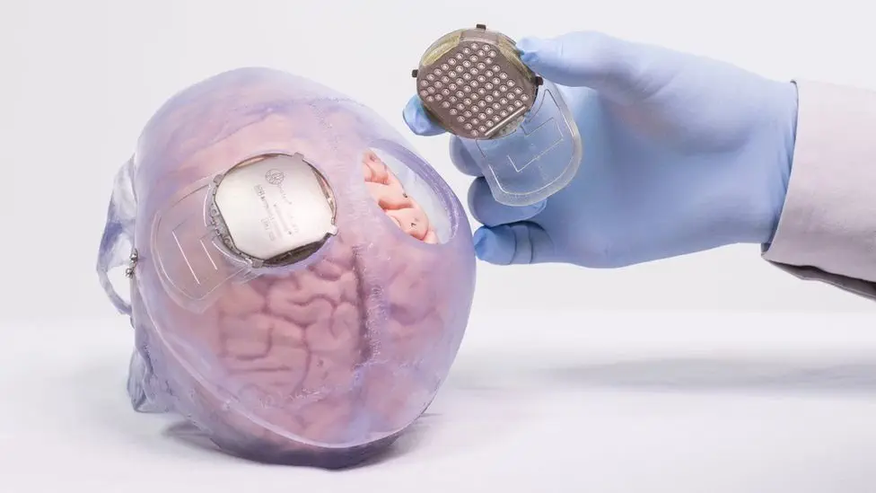 Image credit: Fonds De Dotation Clinatec